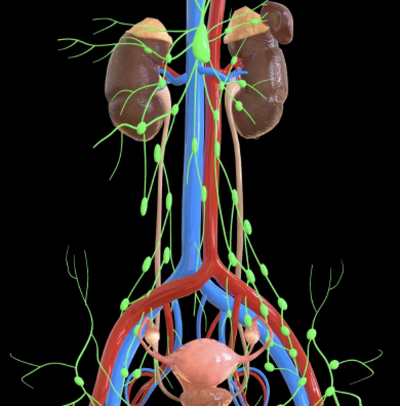 Linfadenectomia Retroperitoneal Robótica